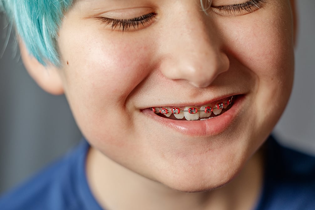teenager with braces